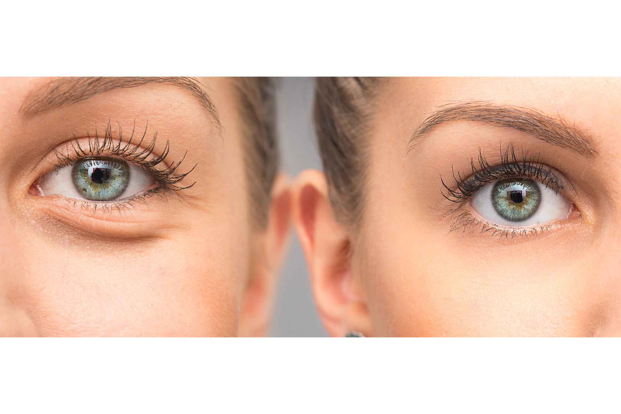 How are your eyes. Eye Light Medicine after and before. Weak Eye after before. Frontless before the Eyes.